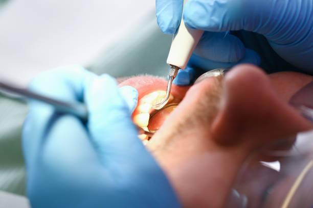 Best Emergency Denture Repair in Dover Base Housing, DE